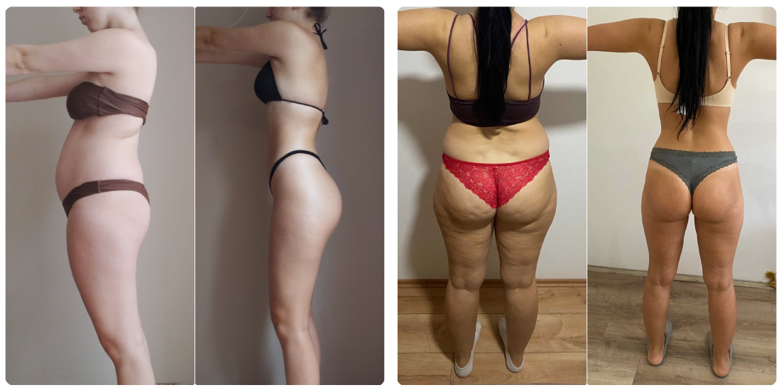 zimski transformacija nikola orozovic